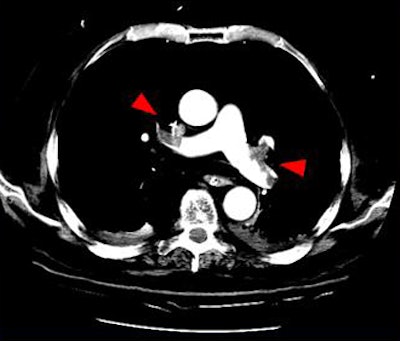 2009 02 03 15 08 20 317 Suh largepe2