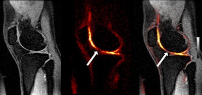 2009 02 04 12 42 48 456 2009 02 05 Earlydetection