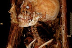 2009 02 05 10 42 52 878 2009 02 05 Mummy