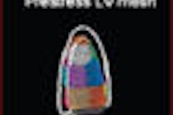 2009 02 11 11 45 00 918 2009 02 06 Walimbe Thumb