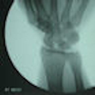 2009 02 25 15 58 49 47 Fluoroscopy Thumb