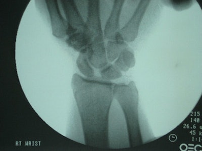 2009 02 25 15 58 51 214 Fluoroscopy 394