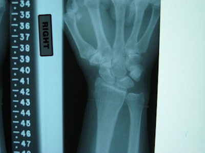 2009 02 25 15 58 55 850 Radiograph 394