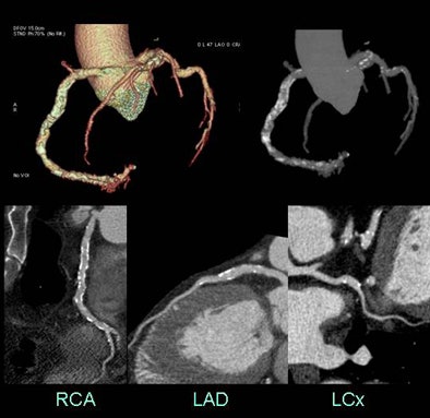 2009 02 26 15 15 43 767 Earls highcstop