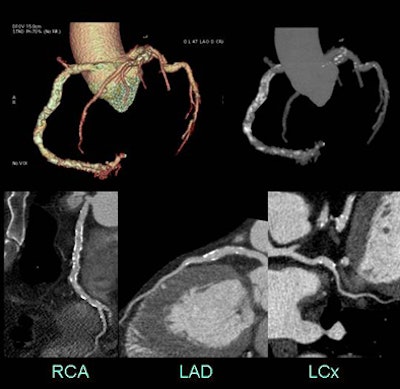 2009 02 26 15 15 43 767 Earls highcstop
