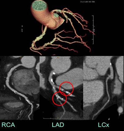 2009 02 26 15 15 46 380 Earls highcsbottom