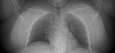 2009 02 26 15 15 47 456 Earls fatpatient