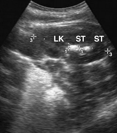 2009 02 27 15 34 55 819 03 08 1867 03a 394