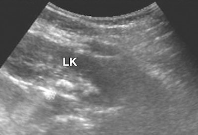 2009 02 27 15 34 56 557 03 08 1867 02c 394