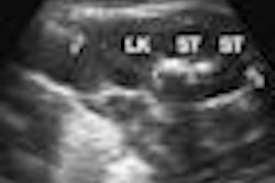 2009 02 27 15 34 57 202 03 08 1867 03a Thumb