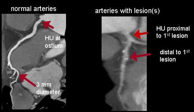 2009 02 27 17 39 19 580 Mitsouras methodstop
