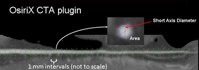 2009 02 27 17 39 20 601 Mitsouras methodsbottom