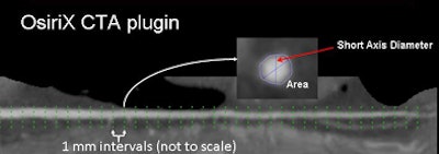 2009 02 27 17 39 20 601 Mitsouras methodsbottom