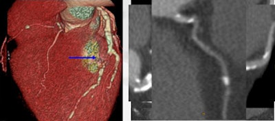 2009 03 08 13 47 22 952 Andreini diabeticpatient