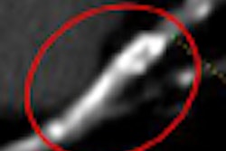 2009 03 08 13 47 25 91 Andreini thumb
