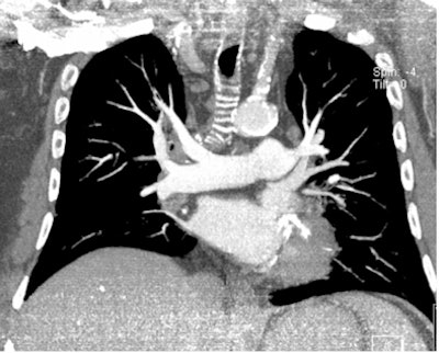 2009 03 11 10 08 37 362 Example 80k Vp 2 Resized