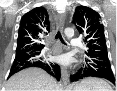 2009 03 11 10 08 39 225 Example 80k Vp 1 Resized