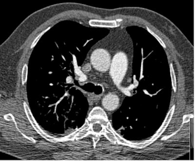 2009 03 11 10 08 42 305 Example 80k Vp 3 Resized