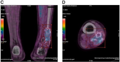 2009 03 11 13 33 41 512 Fdg Osteo Images Cd