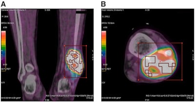 2009 03 11 13 33 42 975 Fdg Osteo Images Ab