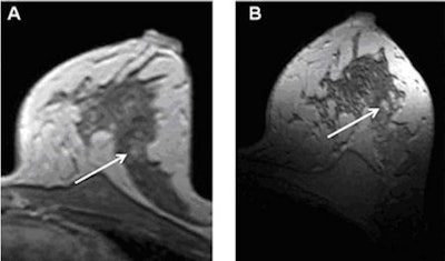 2009 03 12 13 42 36 339 7 Tmammo 1