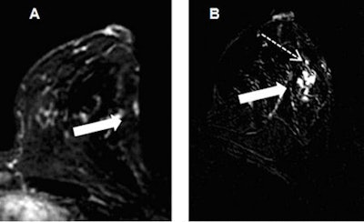 2009 03 12 13 42 37 129 7 Tmammo 2