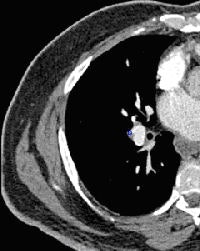 2009 03 25 13 30 07 124 Image3 200