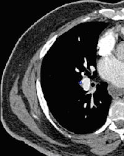 2009 03 25 13 30 07 124 Image3 200