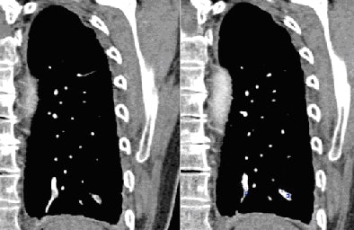 2009 03 25 13 30 09 511 Image2 394