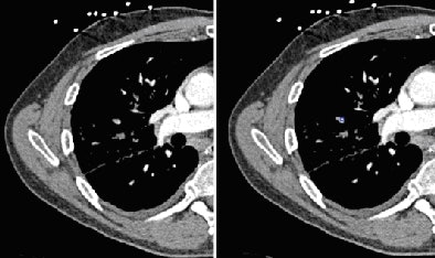 2009 03 25 13 30 10 954 Image1 394