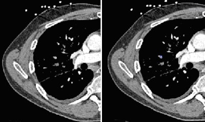 2009 03 25 13 30 10 954 Image1 394