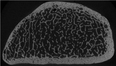 2009 04 01 13 22 56 997 Issever trabecularbone 394