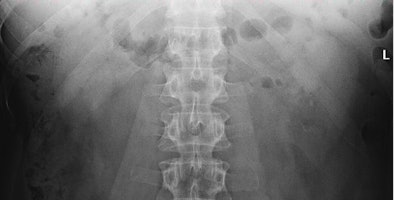 2009 04 01 14 36 00 70 Mermuys2 394