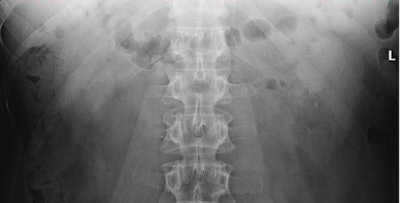 2009 04 01 14 36 00 70 Mermuys2 394