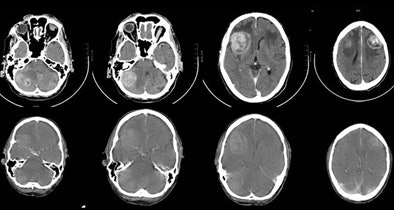 2009 04 01 15 40 33 290 Dewever 67yearold