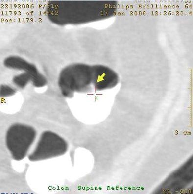 2009 04 07 12 17 36 886 Wi fpartifacts top