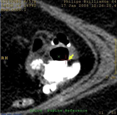 2009 04 07 12 17 38 182 Wi fpartifacts bottom