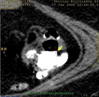 2009 04 07 12 17 38 182 Wi fpartifacts bottom