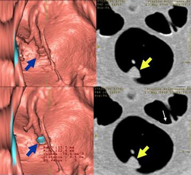 2009 04 07 12 17 41 761 Wi falsenegtop