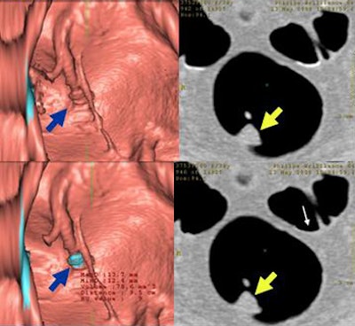2009 04 07 12 17 41 761 Wi falsenegtop
