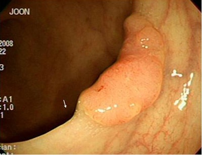 2009 04 07 12 17 43 145 Wi falseneg bottom