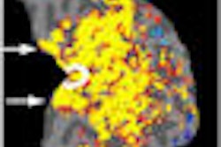 2009 04 07 15 06 59 441 Macular Degeneration2 Thumb