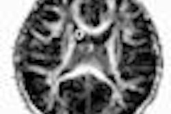 2009 04 15 10 51 10 121 Mri Meth Thumb
