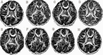 2009 04 15 10 51 10 744 Mri Meth 450
