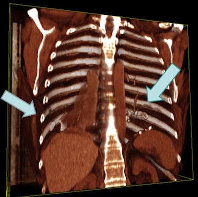 2009 04 15 15 16 37 884 18 394