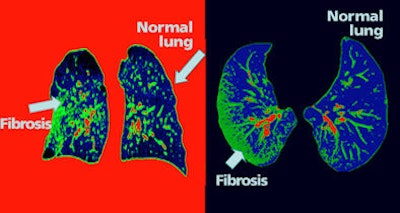 2009 04 15 15 16 38 560 14 16 394