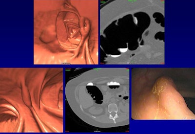 2009 04 29 13 06 11 470 Wise discordant