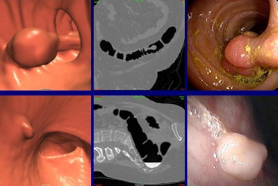 2009 04 29 13 06 12 560 Wise concordant