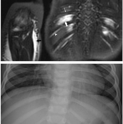 2009 05 06 16 16 40 834 Wb Stir Image 394