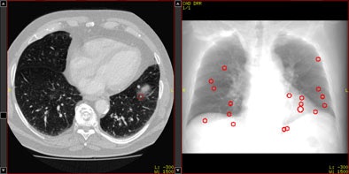 2009 05 08 12 55 09 322 Figure 3 A